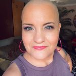 September is alopecia awareness month